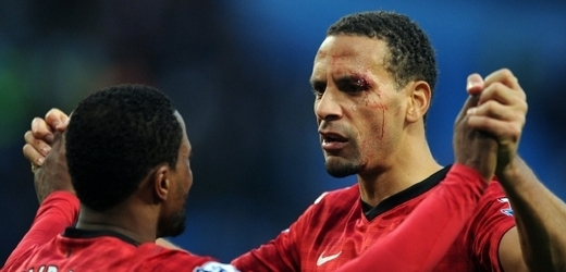 Rio Ferdinand si ze zápasu odnesl krvavou památku.