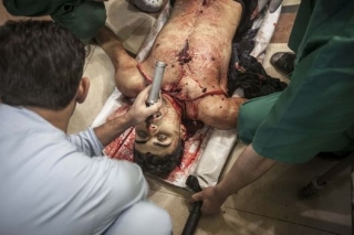 Syrský rebel zasažený armádním odstřelovačem do čelisti po přívozu do nemocnice,.