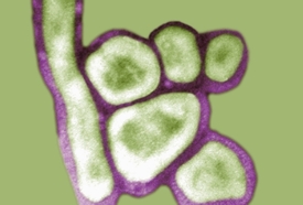 Vir H5N1, takzvaná ptačí chřipka.