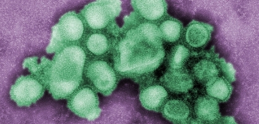 Virus prasečí chřipky pod mikroskopem. Letos zatím epidemie nepropukla, ale nakažených přibývá.