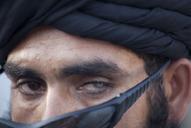 Pákistánský vesničan má poškozené oko údajně po zásahu střepin z rakety vystřelené z amerického letadla.