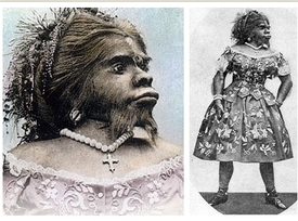 Julia Pastranaová se narodila v Mexiku v roce 1834. Trpěla hypertrichózou a hyperplázií, kvůli nimž měla hustě ochlupený obličej a podsaditou čelist.