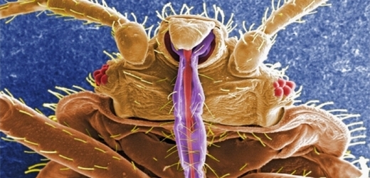 Detail hlavy štěnice domácí s bodcem, kterým si vás narazí (Snímek z elektronového mikroskopu).