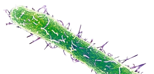 Salmonella typhimurium na snímku z elektronového mikroskopu.