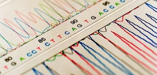 DNA se skládá z jednotlivých nukleotidů, které jsou označeny písmenky. Právě jejich sled rozhoduje o tom, jaké nemoci proděláme.