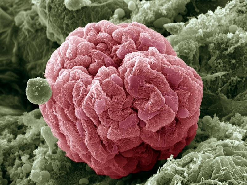 Uměle obarvený snímek z elektronového mikroskopu ukazuje cévní klubíčko glomerulus. Podocyty, buňky, které glomerulus obalují, mají růžovou barvu. Snímek byl zvětšen 650x.
