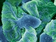 Uměle obarvený snímek z elektronového mikroskopu ukazuje tkáň zdravé ledviny. Fotografie ukazuje struktury glomerul. Jejich povrch je obalen v v buňkách podocyt (modrá a zelená barva). Funkcí glomerulus je filtrování krve a zbavování se nechtěného obsahu krve.