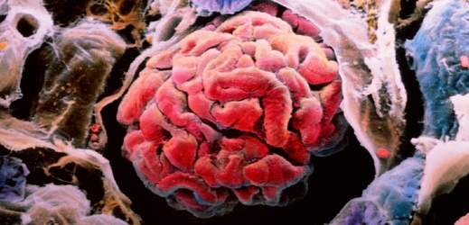 Uměle obarvená fotografie z elektronického mikroskopu, která ukazuje ledvinové tělísko. Renální (ledvinové) tělísko je složeno z glomeruly (červená) a vlásečnice uprostřed, která je obklopena tzv. Bowmanovou kapsulí. Ta je na snímku zčásti vidět jako bílo-hnědá membrána nacházející se pravo uprostřed. V glomerulách probíhá filtrace krve. Filtrát dále putuje do Bowmanovy kapsule, která ho dále předává síti tubul nazvané nefron. Dvě z nich jsou na obrázku obarveny modře.