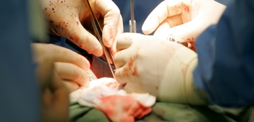 Nová operace by mohla zachránit život desítkám tisíc pacientů.