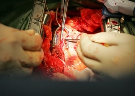 Operace srdce (ilustrační foto).