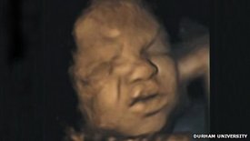 Jedna z fotografií, které zachycují grimasu plodu v děloze (Durham University).