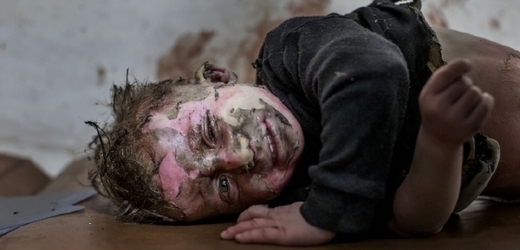 Zraněný syrský chlapec.