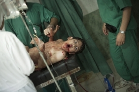 Lékaři v Aleppu se snaží zachránit život hocha, kterého údajně střelil armádní sniper.