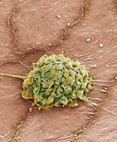 Kupfferovy buňky jsou zvláštní třída makrofágů. Číhají na nepřítele v jaterních cévách.