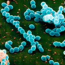 Enterococcus faecalis. Mikrob, jemuž by druhové jméno záviděl jen málokdo.