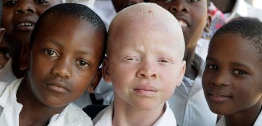 Albinismus je také dědičná nemoc.