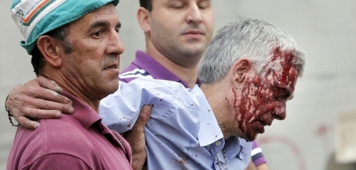 Obviněný strojvedoucí Francisco José Garzón s poraněním hlavy těsně po nehodě vlaku.