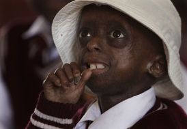 Lidé postižení progerií vypadají jako malí stařečci.