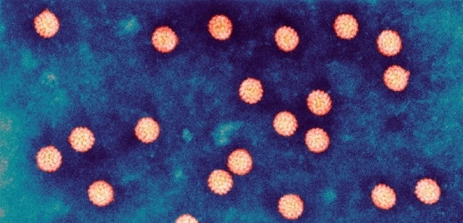 Lidský papilomavirus nezpůsobuje zdaleka jen bradavice.