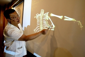 Chirurg v Šanghaji ukazuje rentgen třírukého dítěte.