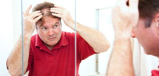 Vlasy velmi často vypadávají mužům ve středním věku. Důvodem může být i špatná životospráva (ilustrační foto).