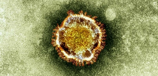 Snímek koronaviru z elektronového mikroskopu.