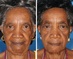 Žena vpravo je kuřačkou již 29 let, ve srovnání se svou sestrou její kůže značně zestárla především kolem očí.