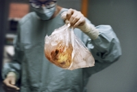 Švýcarský chirurg a lidské srdce v sáčku.