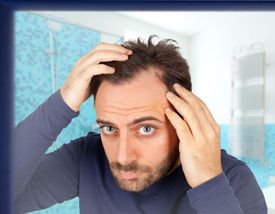 Až osmdesáti procentům mužů bílé rasy vypadávají vlasy kvůli hormonům (ilustrační foto).