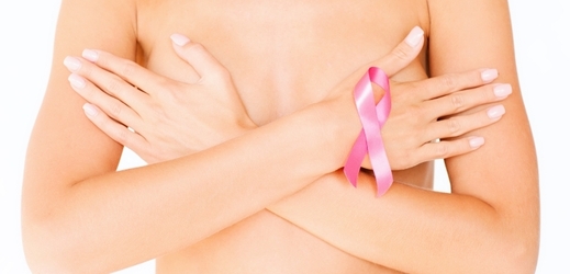 O přínosech mamografického screeningu se debatuje už dlouho (ilustrační foto)