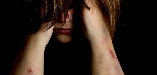 Policie vyzývá napadené ženy, aby se přihlásily (ilustrační foto).