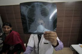 V Indii a jižní Africe je výskyt TBC nejvyšší.
