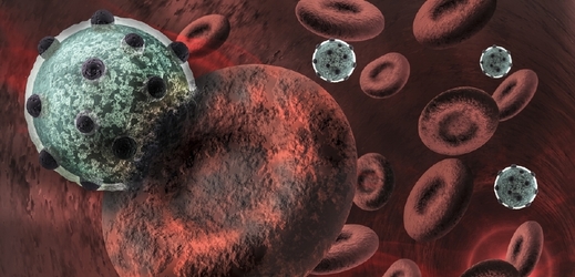 Vir HIV napadá lymfocyty v krvi a ve střevě (ilustrační foto).