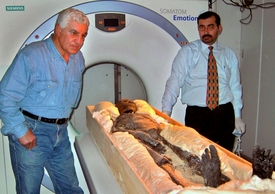 Tomografie mumie faraóna Tutanchamóna v roce 2005.