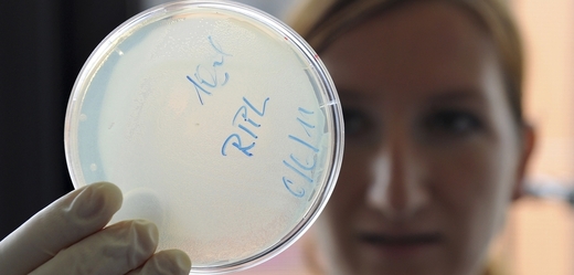 Kultura bakterie E. coli na Petriho misce (ilustrační foto).