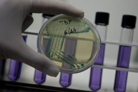 Bakterie E. coli je oblíbený objekt biologických výzkumů.