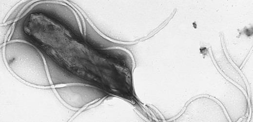 Bakterie Helicobacter pylori se proslavila coby původce žaludečních vředů.