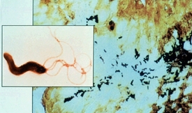 Mikroskopický snímek bakterie Helicobacter pylori, která hraje hlavní roli při vzniku bolestivých žaludečních vředů a zánětů žaludku. Za tento překvapivý a zásadní objev z roku 1982 získali letošní Nobelovu cenu za lékařství Australané Robin Warren a Barry Marshall.