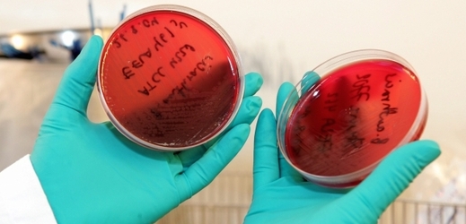 Až 75 amerických pracovníků vládní laboratoře zkoumající nebezpečné nemoci se možná nakazilo antraxem (ilustrační foto).