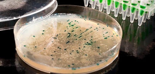 Kolonie bakterie E. coli (ilustrační foto).