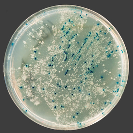 Jednotlivé bakterie nejsou vidět. Ve velkém množství se ale dají vypěstovat na Petriho miskách.