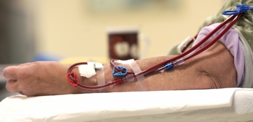 Pacientka dialyzačního střediska na pravidelném pročišťování své krve.