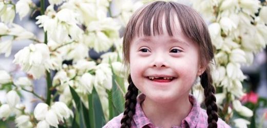 Existuje celá řada typických projevů tohoto syndromu a pak mnoho dalších znaků, které jsou s Downovým syndromem spojeny.