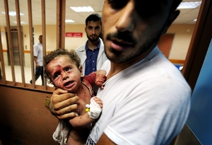Zraněné palestinské dítě.