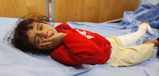 Dívenka zraněná bombou v Bagdádu.