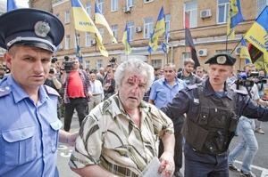 Kyjev se snaží zakázat komunistickou stranu. Na snímku její zbitý přívrženec v Kyjevě.