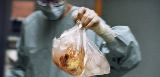 Srdce určené k transplantaci (ilustračení foto).