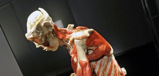 Na výstavě bude 230 exponátů lidských těl a jeho částí.