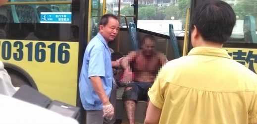 Ošetření jednoho ze zraněných dělníků.