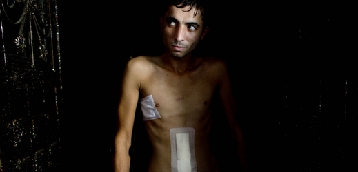 Doživotní traumata - zraněný mladík v Gaze.